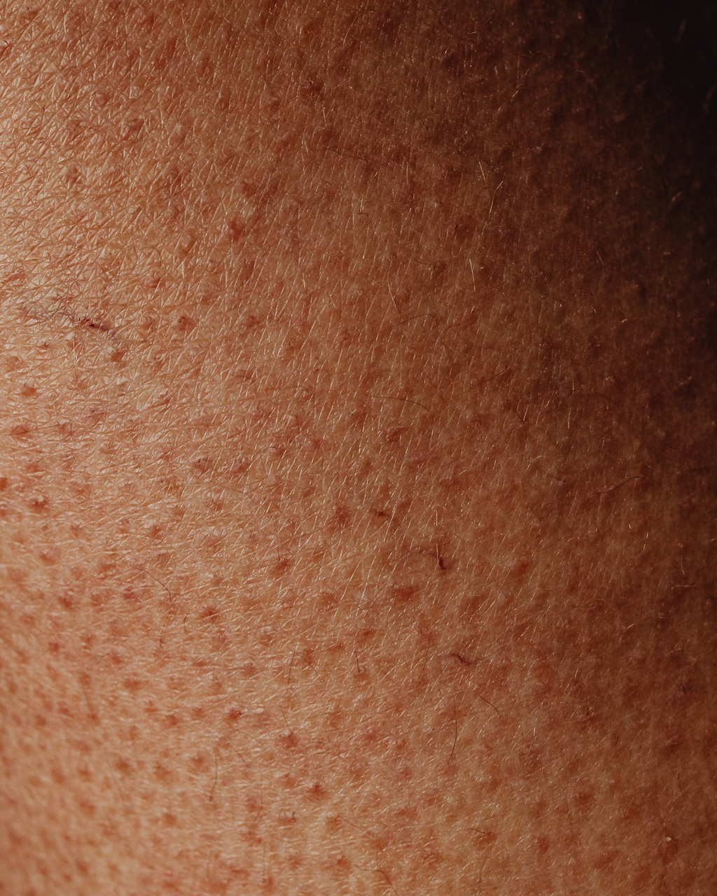 Close-up of skin, Opal is suitable for sensitive skin